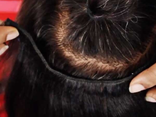 The Leading Expert Hair Fixing in Mangalore, Hair Fixing Mysore